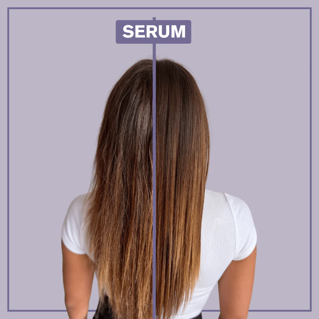 Serum - Image 3