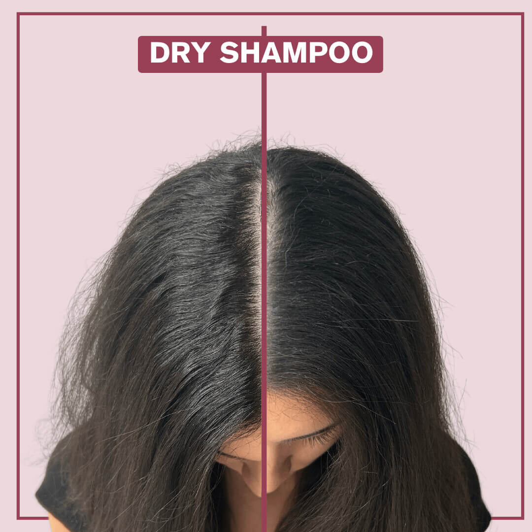 Dry Shampoo - Image 3