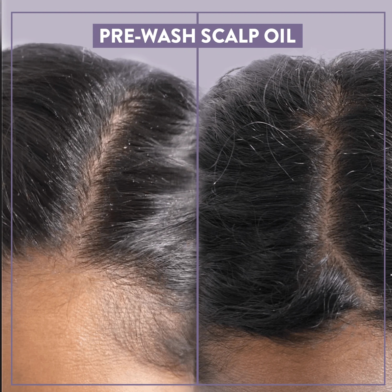 Pre-Wash Scalp Oil - Image 3